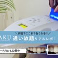 ホワイトニングHAKU通い放題プラン体験記｜結婚式前に通ってわかった効果と注意点【写真あり】